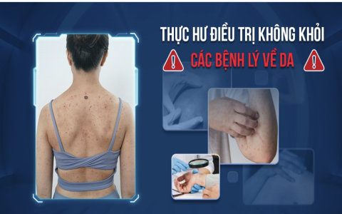 Điều trị bệnh lý da với các yếu tố do cơ địa, bẩm sinh hay đặc biệt liệu có dễ?